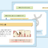0127_親知らずのむし歯とお手入れ方法について【デジタルサイネージ】