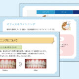 0135_オフィス・セルフ・ホームホワイトニングの違いの解説【デジタルサイネージ】