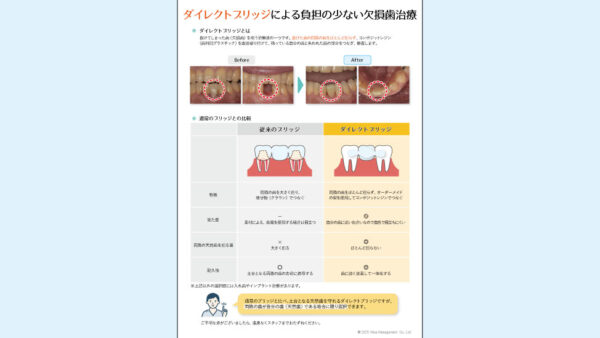 0140_ダイレクトブリッジによる負担の少ない欠損歯治療