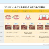 0141_コンポジットレジンを使用した治療3種の比較表