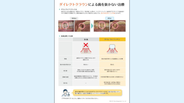 0139_ダイレクトクラウンによる歯を抜かない治療