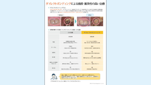 0138_ダイレクトボンディングによる強度･審美性の高い治療